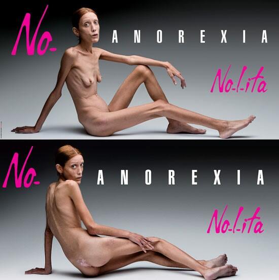 HelpAnorexia00's tweet image. No Anorexia