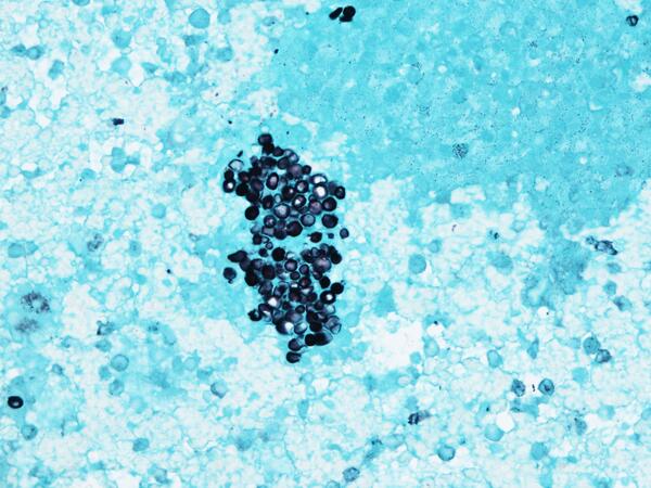 Kristie White, MD tweet media