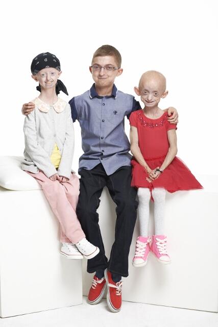 ProgeriaUK's tweet photo. Friends Forever #progeria http://t.co/b1zCkcsAj0