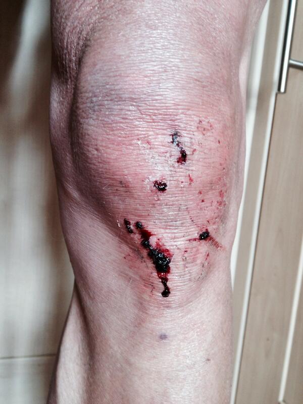 nickmardon's tweet photo. My boy fell off his bike 😳 no harm done http://t.co/5y7SMoBBU4