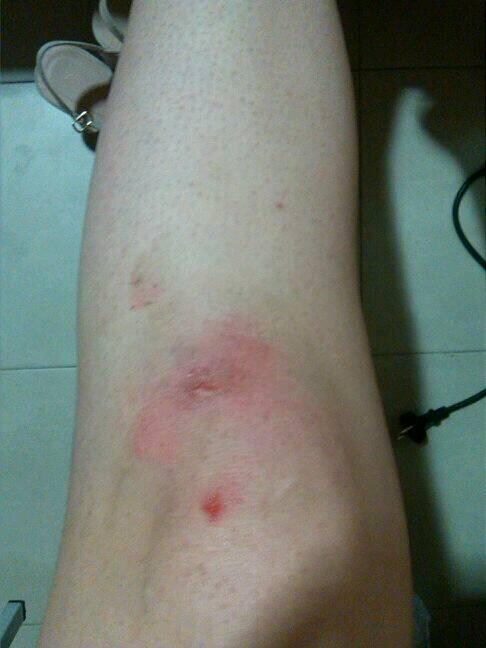 irenec30's tweet photo. Las aceras de sevilla contra mi.. http://t.co/ystPhO3WDW
