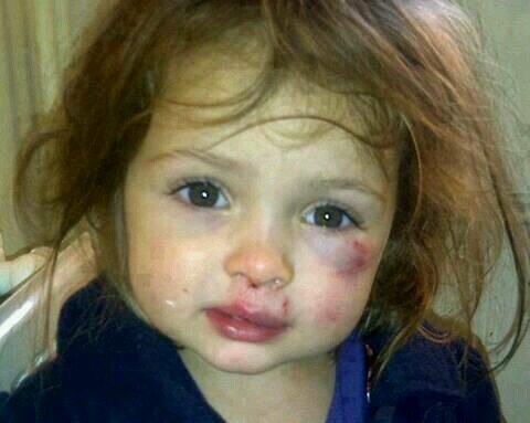 Srta_Sheila's tweet photo. Teneis un segundo para dar RT si estás en contra del maltrato infantil. http://t.co/lT60j0SgBm