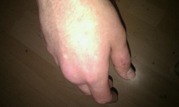 NathanzoonyNw's tweet photo. @mikepassmore1 noone kicks my front door this time of night #hurt http://t.co/cmTEruvL1y