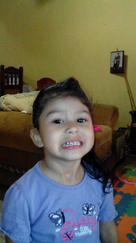 rantripa's tweet image. Mi chika dientes de lata #dientes #amordefamilia #Bella
