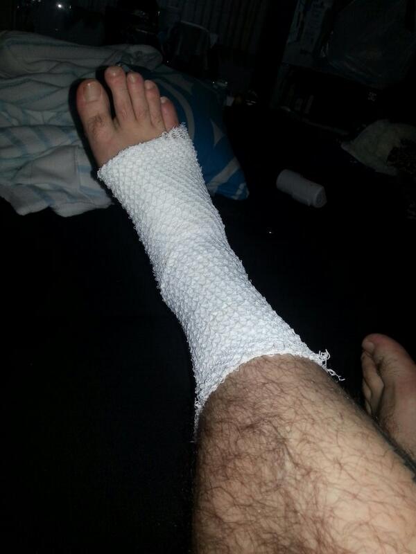 Se acabo la temporada para mi
Fuerte esguince de tobillo y un tiempo sin.apollar el pie en el suelo