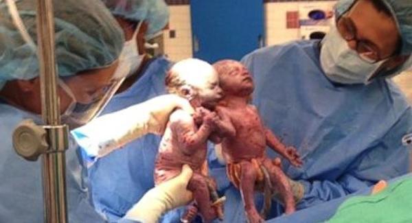 “<a href="/EliteDaily/">Elite Daily</a>: These twins couldn't let go of each other's hands after birth: elitedai.ly/RAySYd ” <a href="/BaileyLiackman/">Bailey Liackman</a>