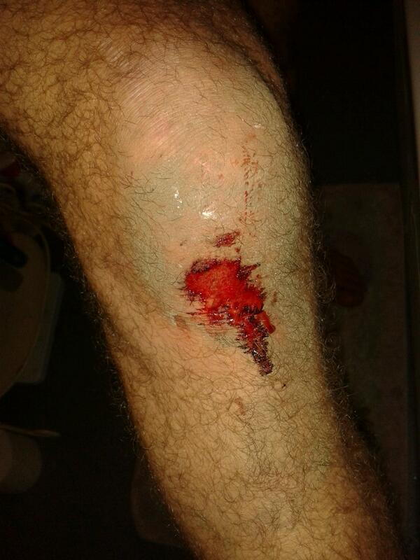 bertwells12's tweet photo. Still had one more burn in me for cup final tonight.plus extra time..... all done now till next season. http://t.co/7kKby6oXHF