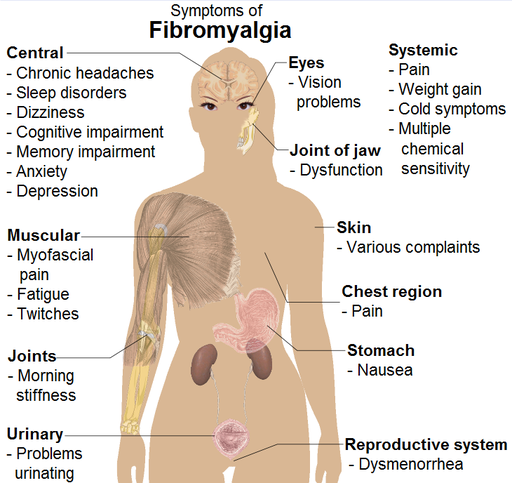 Please RT #fibroawarenessday @KIRSTYSTRAIN @DrDawnHarper @pixiedoctor @DrChrisSteele @DoctorChristian