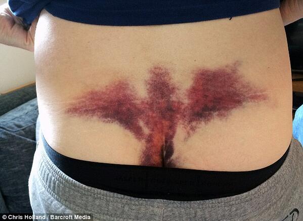 DailyMailUK's tweet photo. Groom thinks wedding is blessed because he fell on stag do and got holy bruise http://t.co/FfhRikzORq http://t.co/hCvUBFTWoo