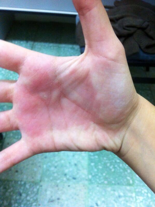 Technomumapp's tweet photo. Thanks to @AmenahAl who suggested the salt and ice challenge #challenge_technomum #victim http://t.co/hk2sWoINsd