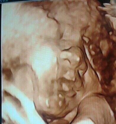 robertoescal's tweet image. Assier en 3D. Y cuando patea es en 4D.