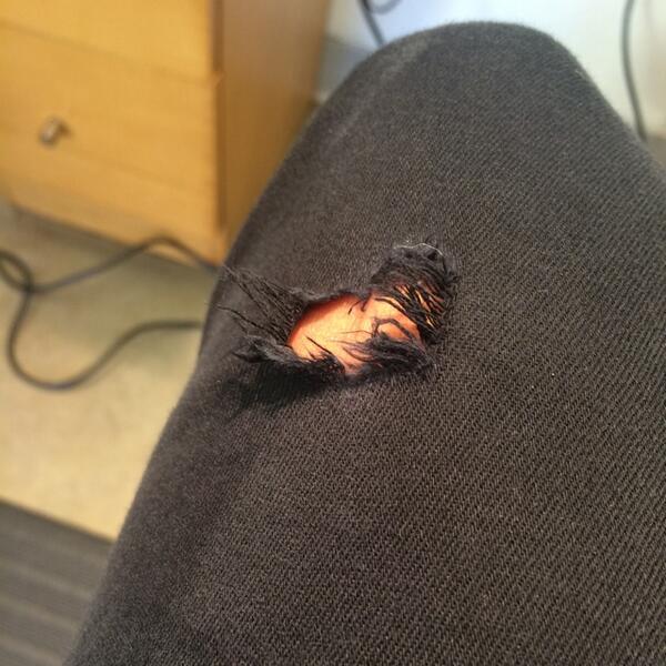 alexa_collins's tweet photo. A part of me wants to sew up this hole in my jeans but there is another part that likes watching it grow. http://t.co/R6z9FZQD0Y
