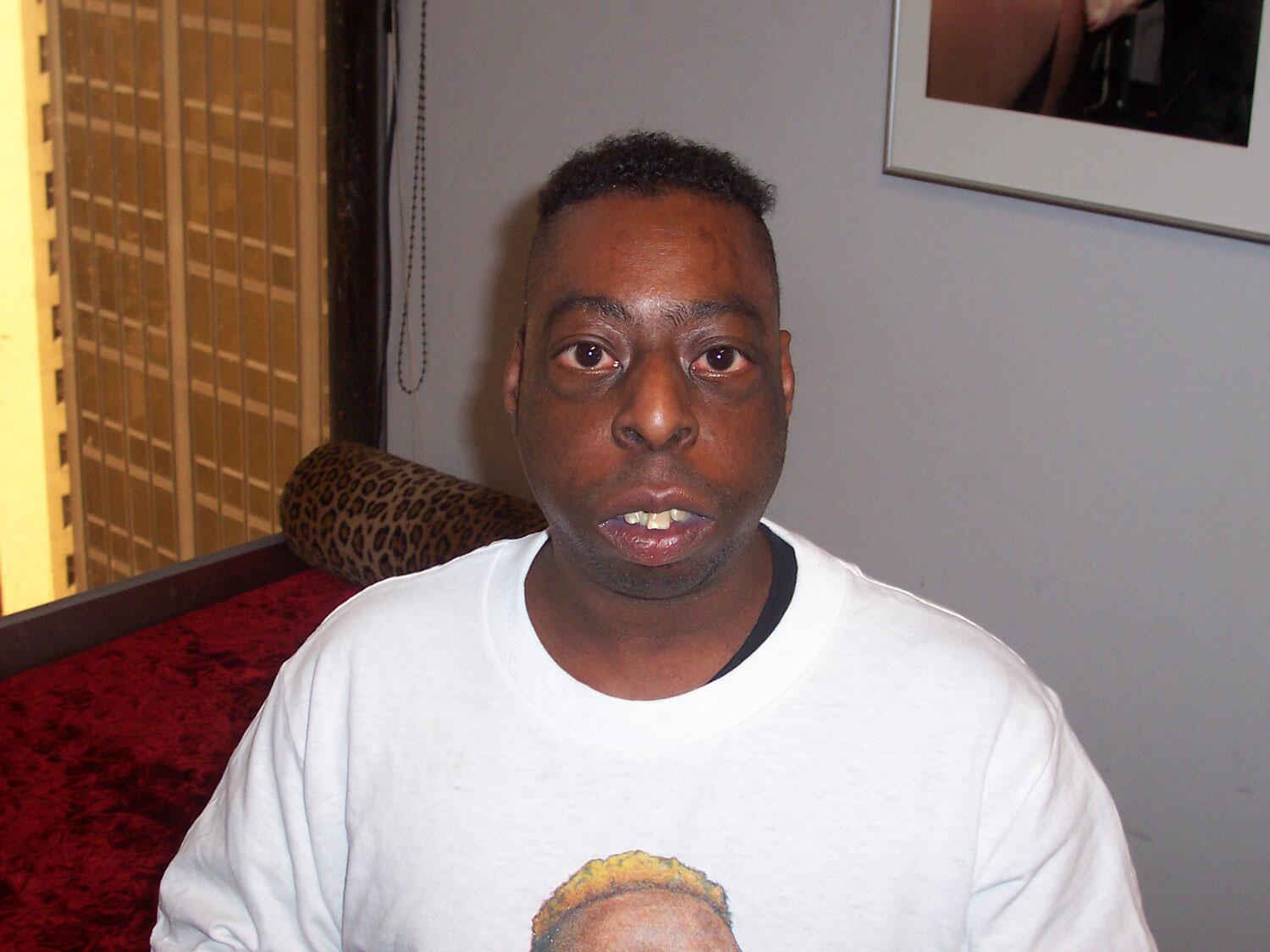 Stern Show on Twitter "TBT a young Beetlepimp from May 2004 