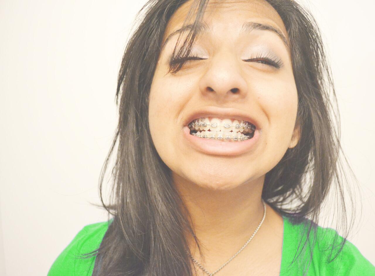 Girls With Braces on Twitter "CHEEEEZZ! braces http//t.co/Bq5V4ULUvI