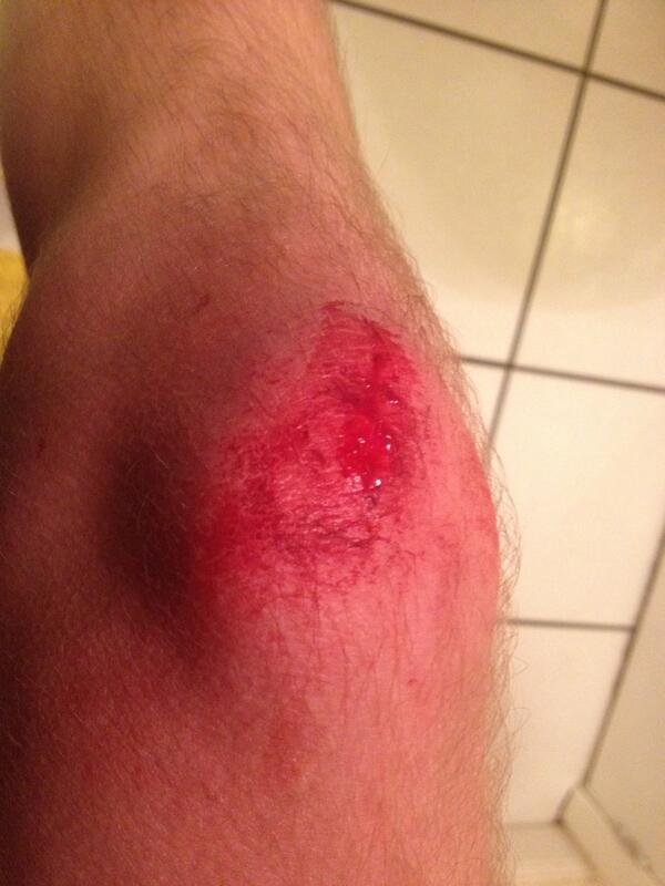 Jacob_Of_Legend's tweet photo. I used to be an adventurer like you.....until I took a forklift to the knee. #ForkliftDriverProbs http://t.co/jGLNGEwdiA