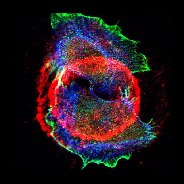 human epidermal keratonocytes stained with antibodies against actinin-4 (green), laminin-332 (red), and f-actin labelled with phalloidin (blue)