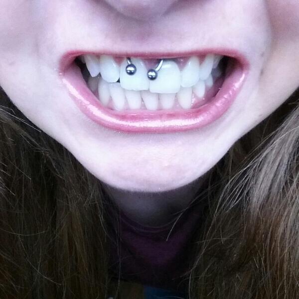awsglasgow's tweet photo. Happy white smile😀😆 #teethwhitening #allwhitesmile #greatresults #happyclient #smiley #brighter #whiter #XO #woo http://t.co/EelFU3WerR