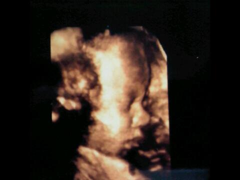 Stemganus's tweet photo. My baby http://t.co/jz3Zpfnct0