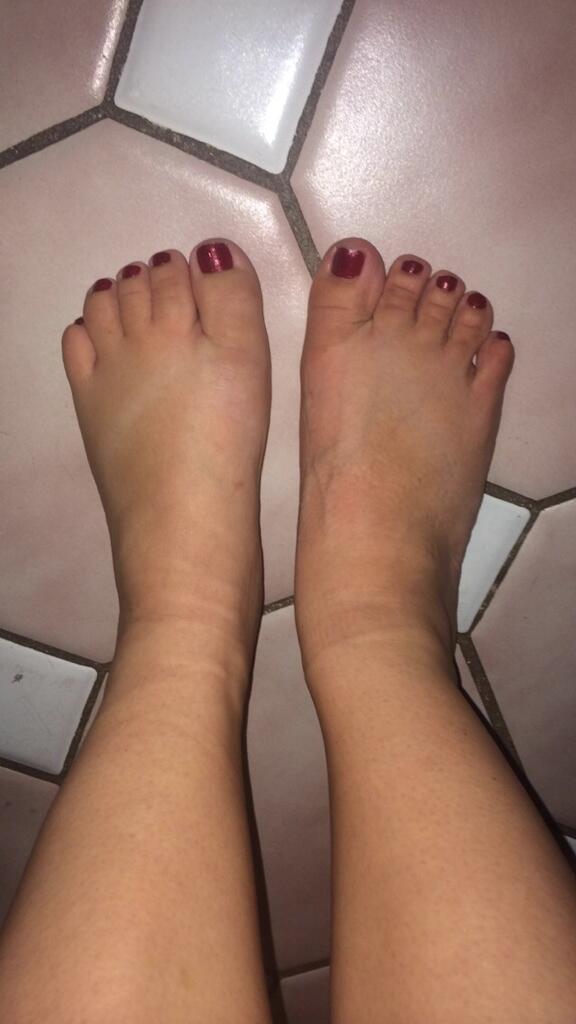 courtannsen's tweet image. Guys.... My left foot is so swollen. This is so gross 😭😳🙅 #sprained #disgusting