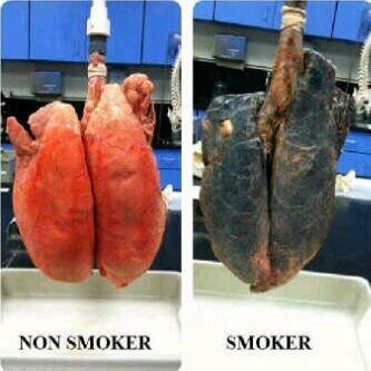 MedicalSecret's tweet image. World No Tobacco Day! #HTTS2014 @ISMKI_Indonesia @ismki_wilayah2 @PBIDI