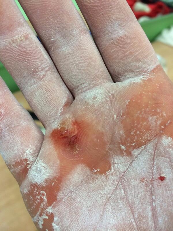 albahaltera's tweet photo. No pain no gain http://t.co/GGk0LqRBBU