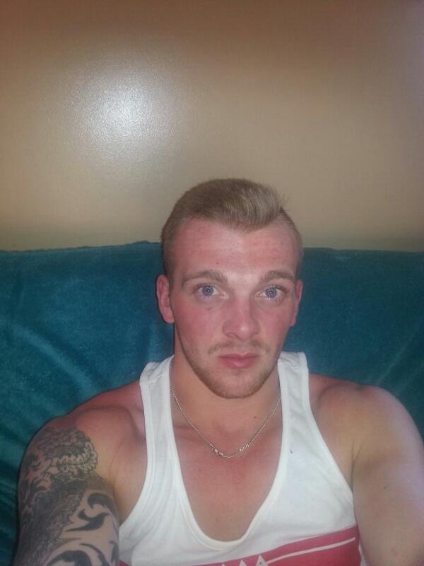 DidgeV's tweet photo. Sunburnt #sunburn #red http://t.co/sjH9BWMUEU