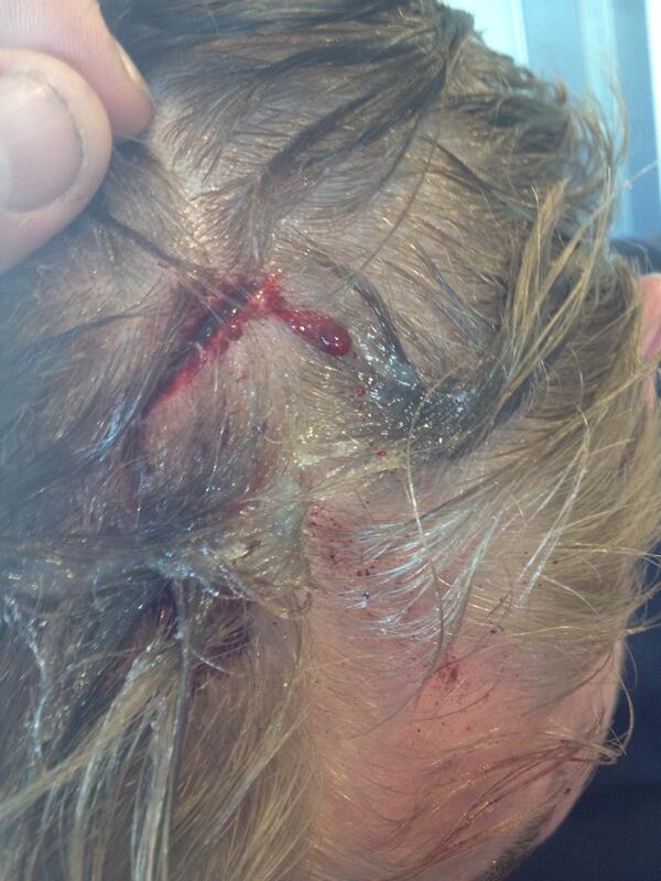 Jack Timmis tweet media