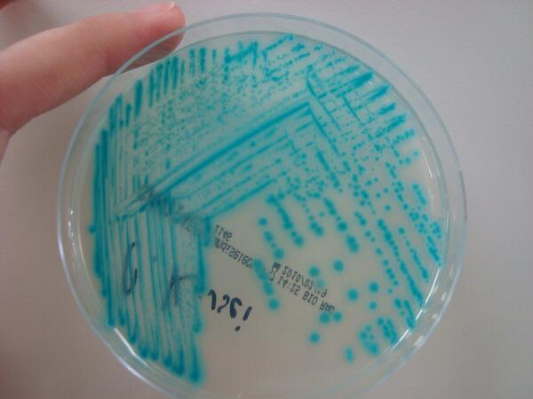 ComClnic's tweet photo. Candida krusei, sobre cromoagar Candiselec4 http://t.co/eUzfR9srmc