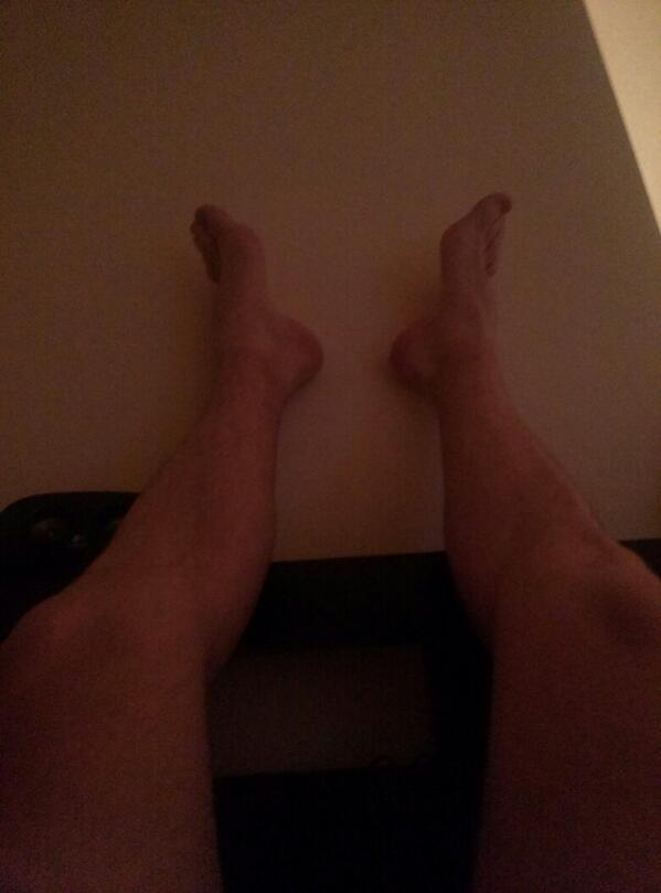 Mattyicetri's tweet photo. Leg are hurting big time. Recovery time! http://t.co/YrqOLajNM1