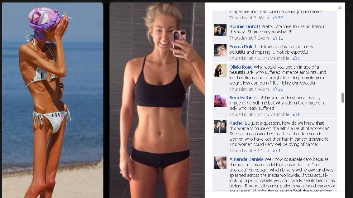 Еда на женщине. Девушки до и после анорексии. Рейчел фаррух анорексия 2020. Девушки после анорексии. Фигура стройная но с животиком.