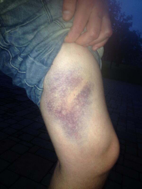 cedgarsepels's tweet image. Mazulītis izaudzis #bordercup #shootblock