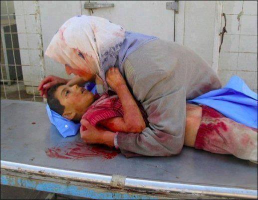 farukberkkara's tweet photo. Suriye'de biz ne yaptık ki diyen ileri zekaaaa....
ALLAH SENİ GÖRMÜYOR MU ZANNEDİYORSUN ?
YANDINIZ OĞLUM YANDINIZ http://t.co/OTf5A297wX