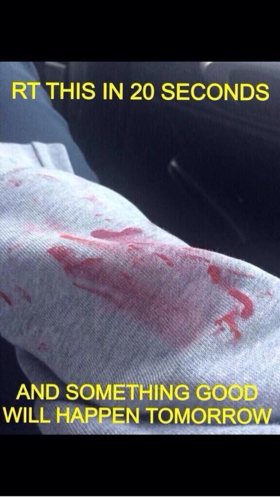 krxstenxo's tweet image. remember that you opened it, not me