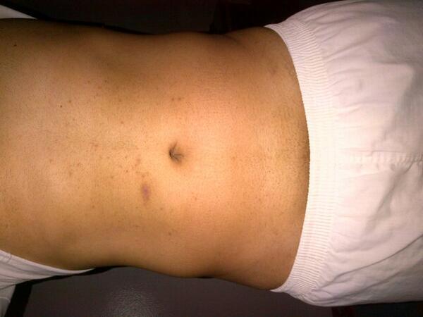 نحفت بعد ارجيم