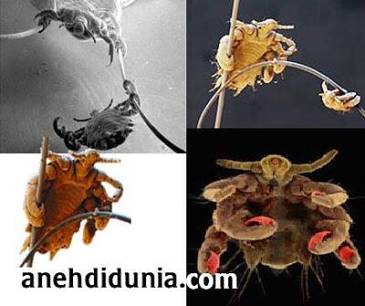 Yadong_Planet's tweet photo. Pediculosis pubis atau sering disebut dengan kutu kepiting (crabs) karena bentuknya mirip kepiting kak. http://t.co/ohondI8dvI