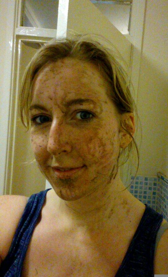 sazhags's tweet photo. #raceforlife #prettymuddy 5k done and loved it!! #letsbeatcancer http://t.co/bUetX3flpo