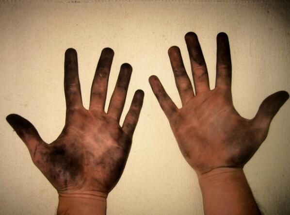 nhlchirpz's tweet photo. Patrick Kane's hands http://t.co/5TlKneQfY4