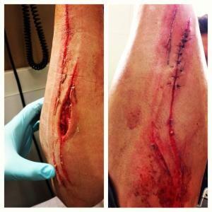 Seanny__Bravo's tweet photo. To all you baseball haters that say baseball isn't a contact sport... Screw y'all! http://t.co/eiLJHSELsv