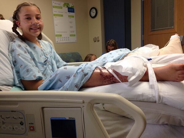 fatcattle1's tweet image. Prayers for a healthy recovery from ATV accident #2brokenlegs #whatididthissummer