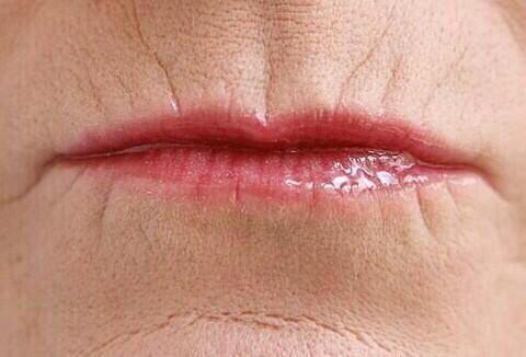 jezriel12's tweet photo. White peoples lips look like open wounds http://t.co/EEMTquqFhW