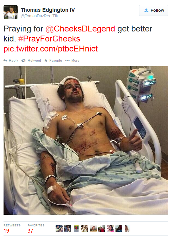 fox5sandiego's tweet photo. Isla Vista survivor gains support from Twitter users #PrayForCheeks http://t.co/uOeeEpOwYy http://t.co/3aypcHiJY8