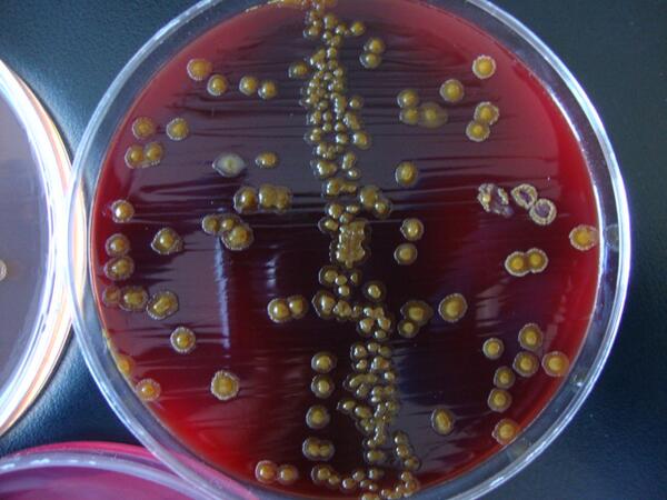 ComClnic's tweet photo. Pseudomonas oryzihabitans, su característica de crecimiento es de  "huevo estrellado" http://t.co/BdttprL6tF