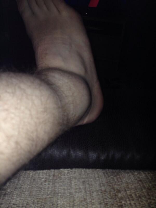 onechord_js's tweet image. @powerleagueUK this is the damage now... Cant wait till tomorrow #unabletowalk #unabletowork