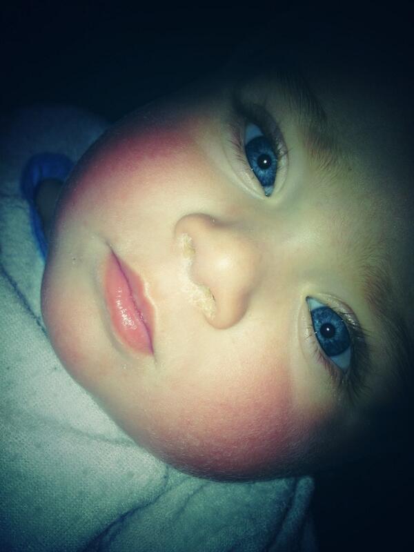 Look at my cheeks red hot sick baby