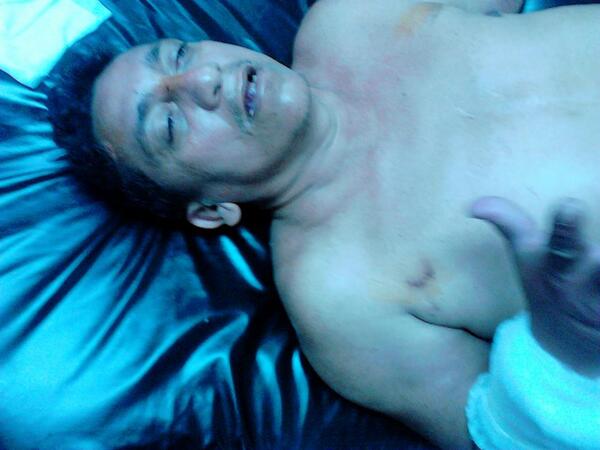 CryptoLogicHQ's tweet photo. #ServicioPúblico Sr no puede hablar lo tienen en Hosp Pérez Carreño, ningún familiar lo ha buscado, fue golpeado RT http://t.co/XVnxBpV517