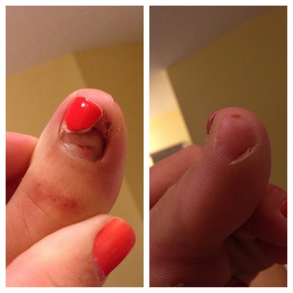 _sassylassie's tweet image. #pitcherproblems