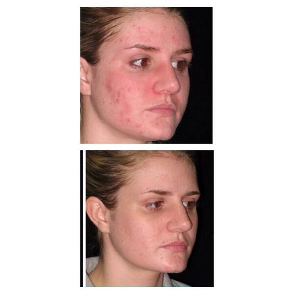 الي حابين يطلبون من الكريم او يستفسرون يقدرون يكلموني ع الخاص او ع البي بي 
Pin:24E43DCC 
الكميه محدودة ❤️🌹