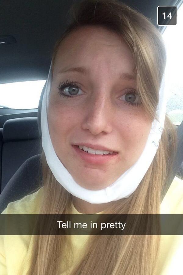 FakeKaylaHutch's tweet photo. Peace out wisdom teeth ✌️ http://t.co/MRG3sgo3Gc