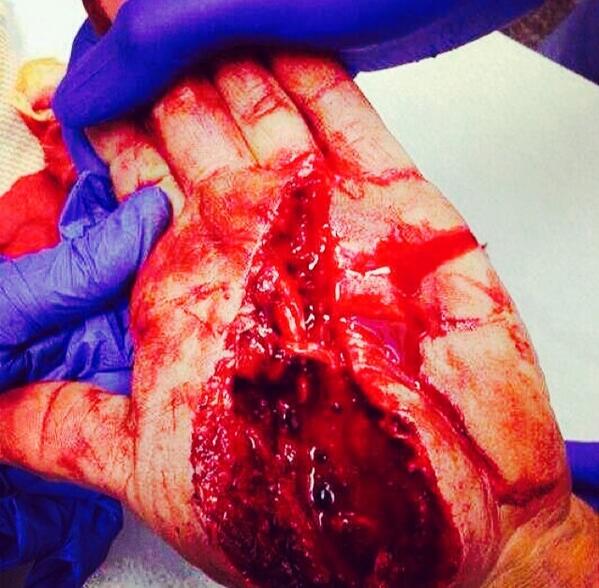 JeanPaulSol's tweet photo. Trauma, Urgencia! http://t.co/7T6nfC8KEd