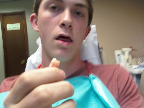 joeynads's tweet image. chillin with my wisdom tooth #novacaine